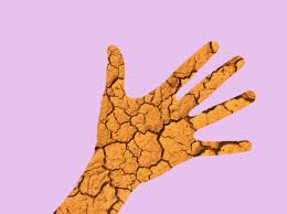 DRY CRACKED "COVID" HANDS! Tips For Keeping Your Hands Clean, Sanitized and SOFT.